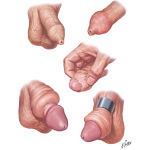 1468