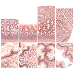 Endometrial Cycle