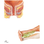 Illustration of Female Urethra from the Netter Collection