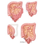 Surgical Resection of Colon Cancer