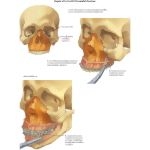 22982