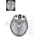 29714