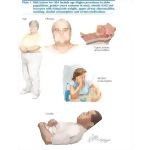Risk Factors for Sleep Apnea