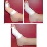 Taping Procedures: Turf-Toe Taping
