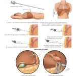 47567