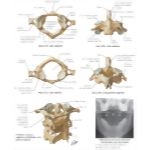 Cervical Vertebrae: Atlas and Axis Spine: Osteology