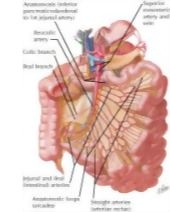 51732