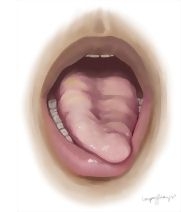 57768