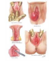 58356