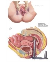 58364