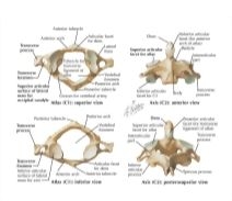 Cervical Vertebrae: Atlas and Axis