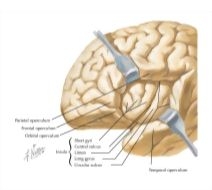 60501