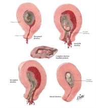 60658