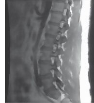 60810