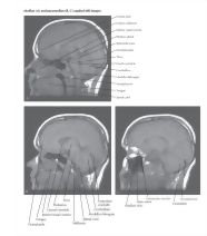 60864