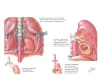 61588