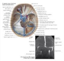 Dural Venous Sinuses Dural Venous Sinuses