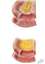 64030