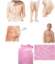 64170