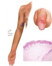 64226