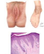 64237