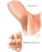 64396