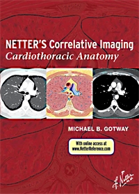 Cardiothoracic Anatomy - Gotwa...