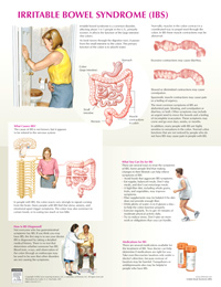 Irritable Bowel Syndrome